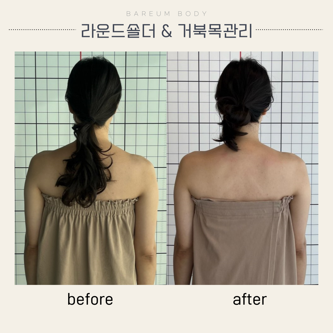 바름바디케어