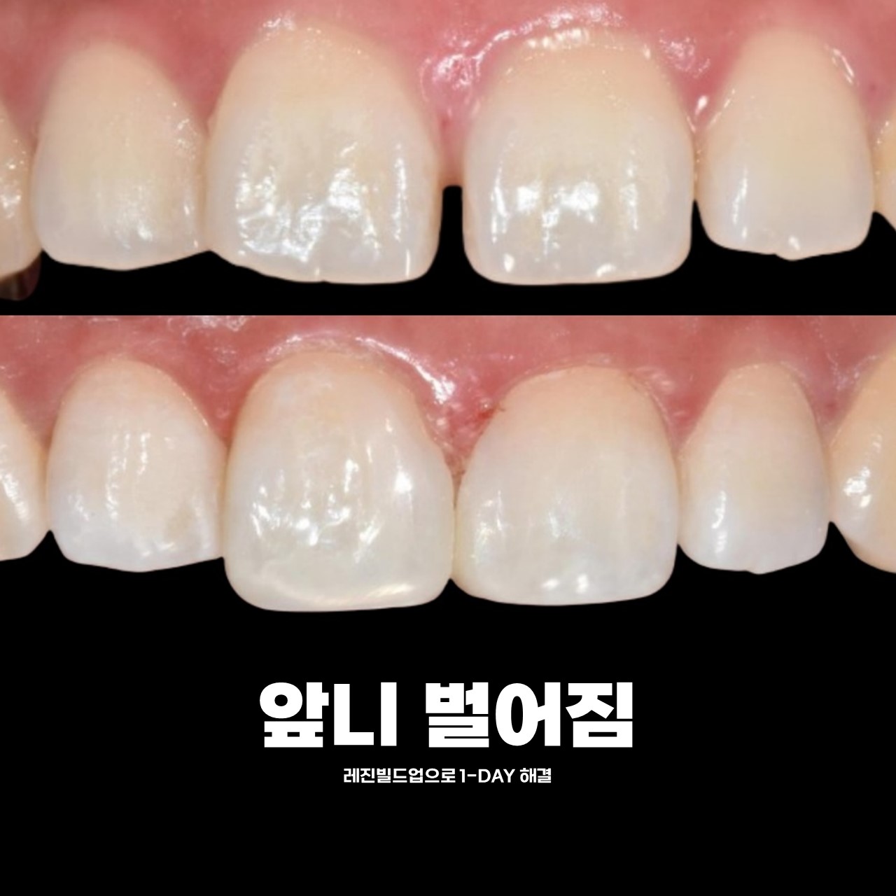 서울스마트치과의원 은평 대표 이미지