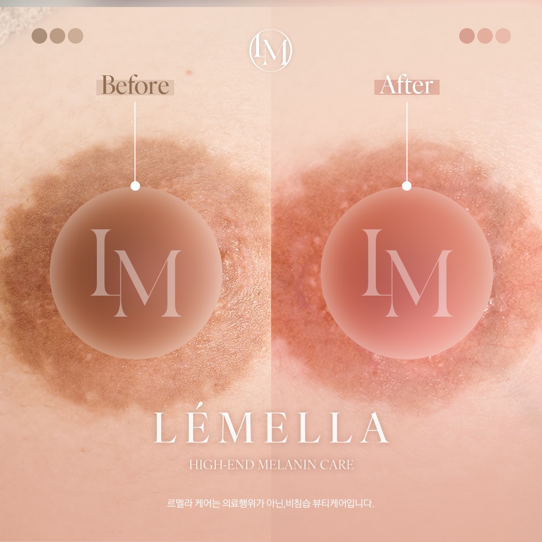 원플랜 에스테틱 대표 이미지