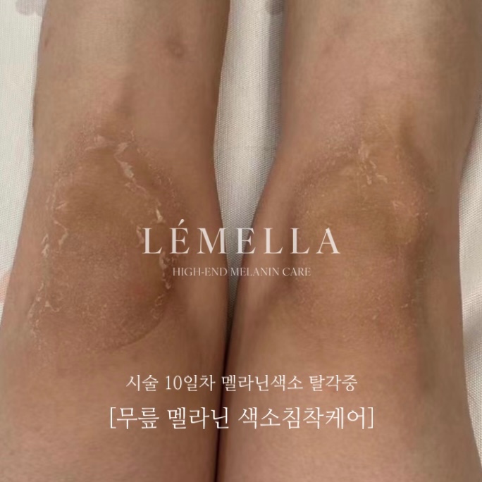 원플랜 대구 피부&에스테틱 대표 이미지