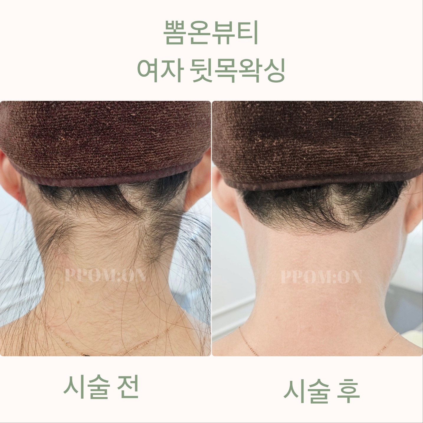 뽐온뷰티 대구본점