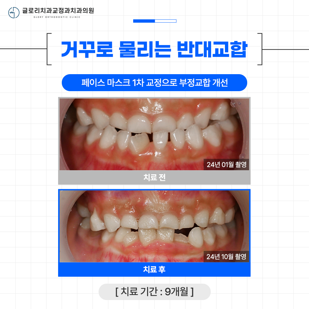 글로리치과교정과치과의원 대표 이미지