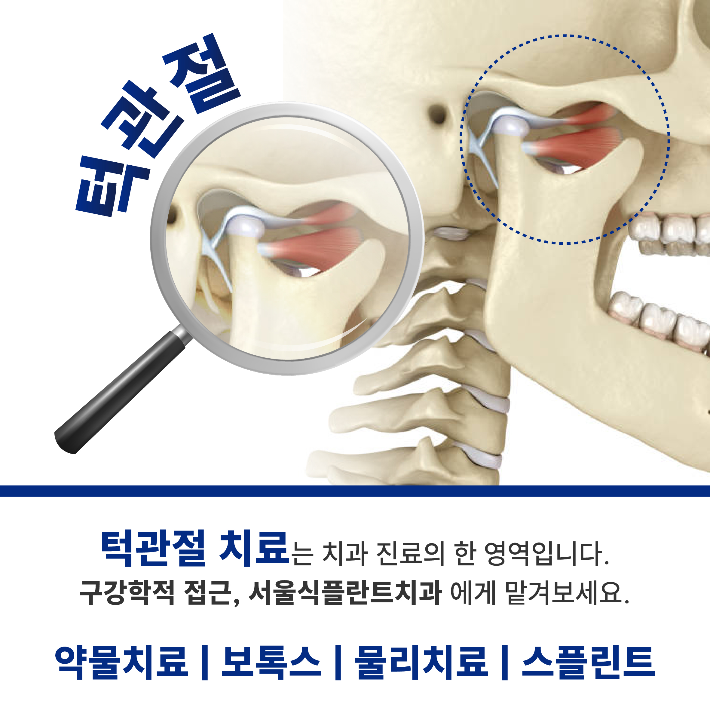 서울식플란트치과의원 대표 이미지
