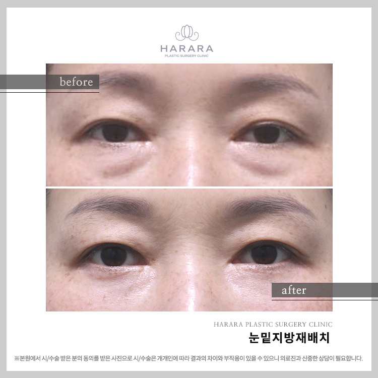 하라라성형외과의원