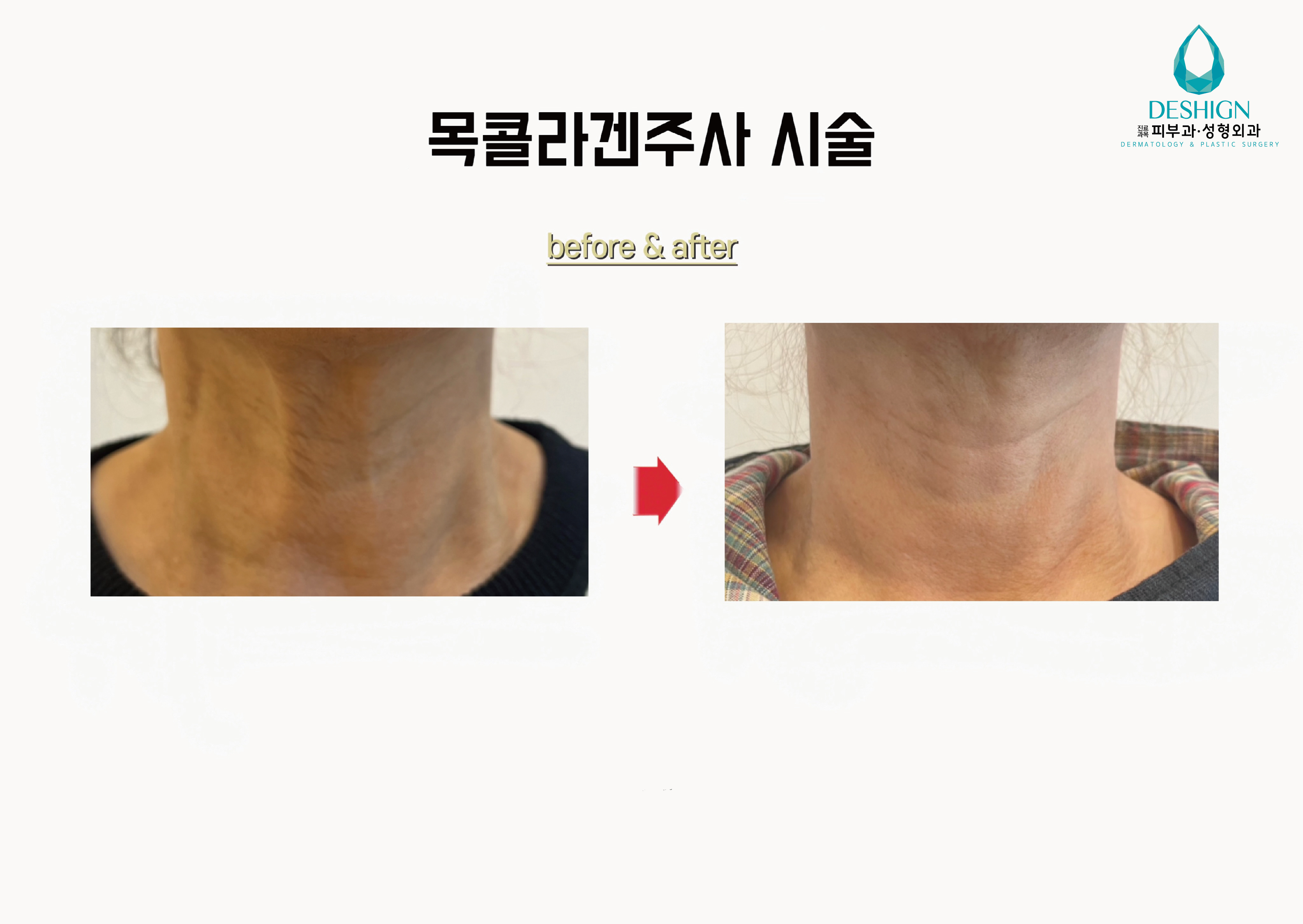 디샤인의원
