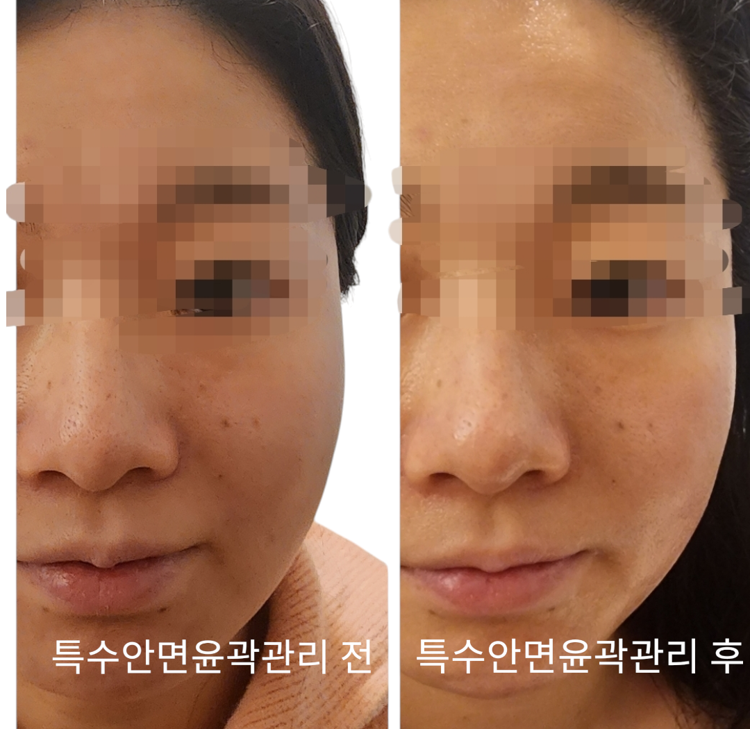 쑴숨쉬듯휴식하다&숲칼프
