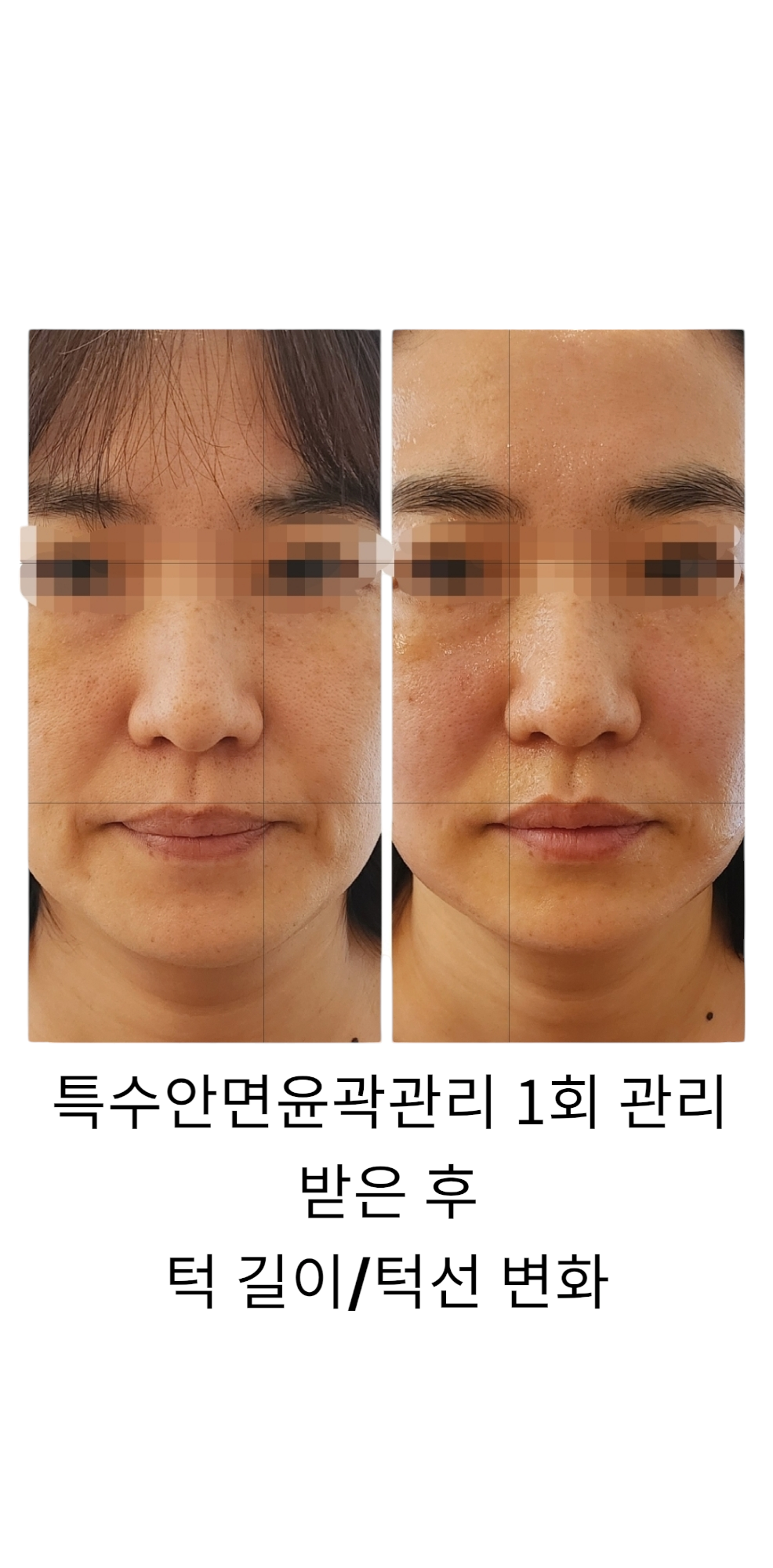 쑴숨쉬듯휴식하다&숲칼프