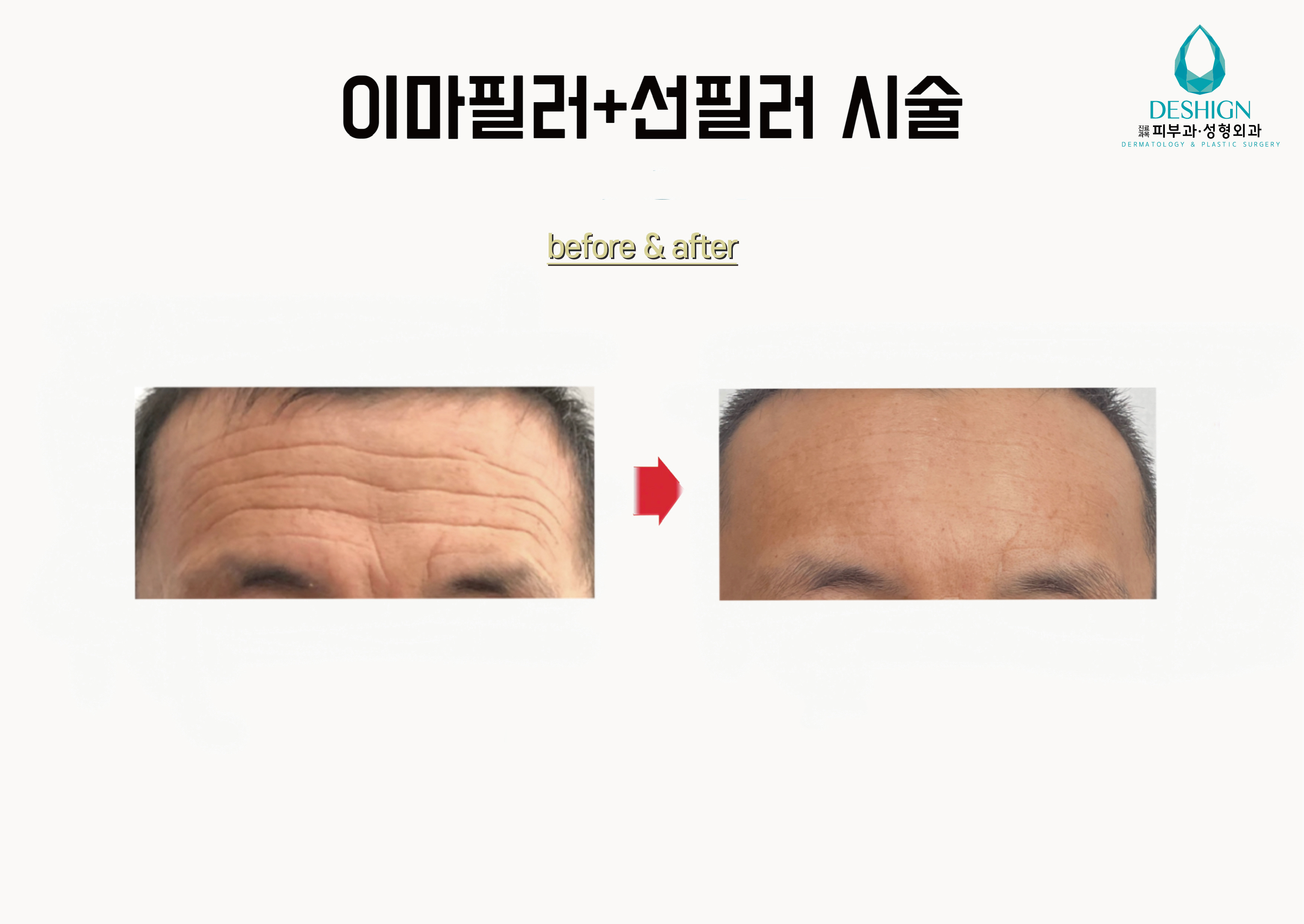 디샤인의원 대표 이미지