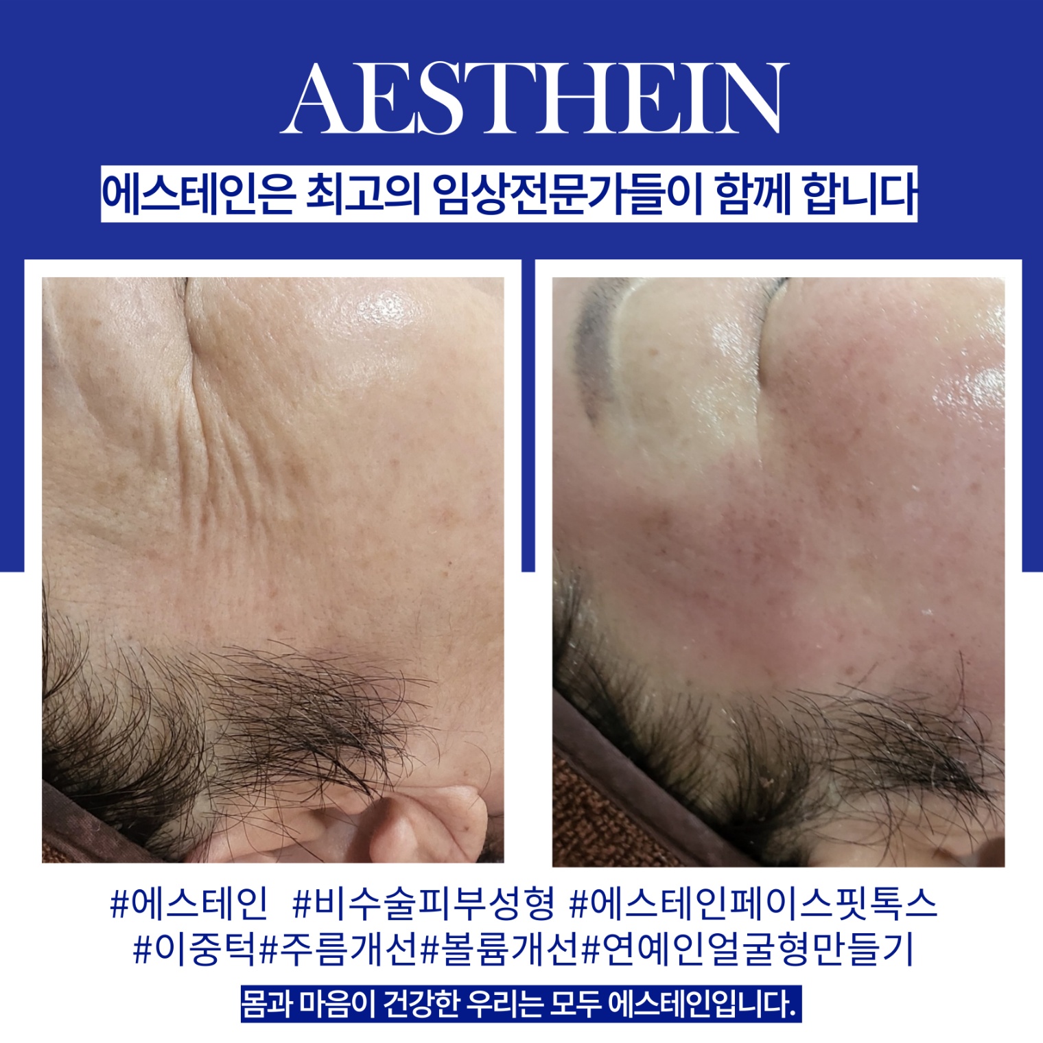 피부의봄에스테틱