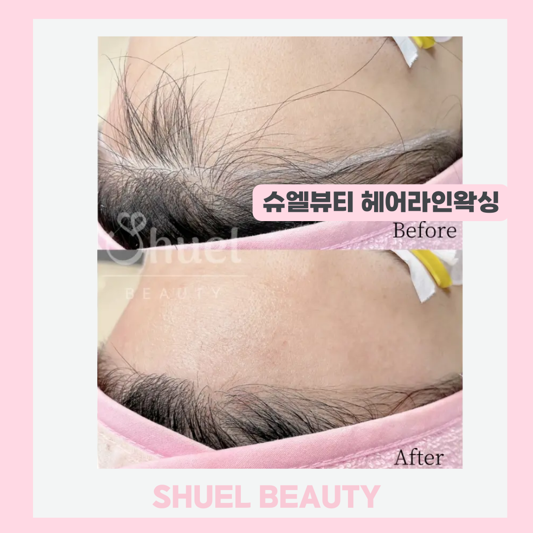 슈엘뷰티