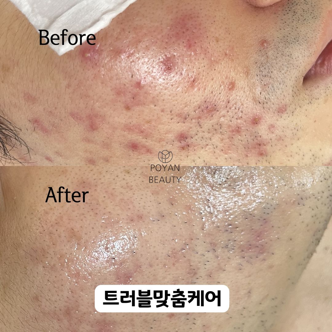 뽀얀뷰티 대표 이미지