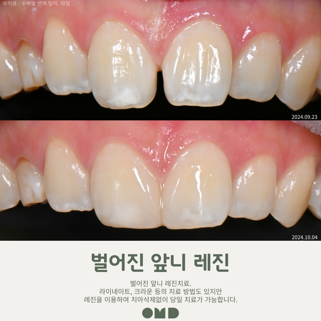 이보다치과의원 부천본원 대표 이미지