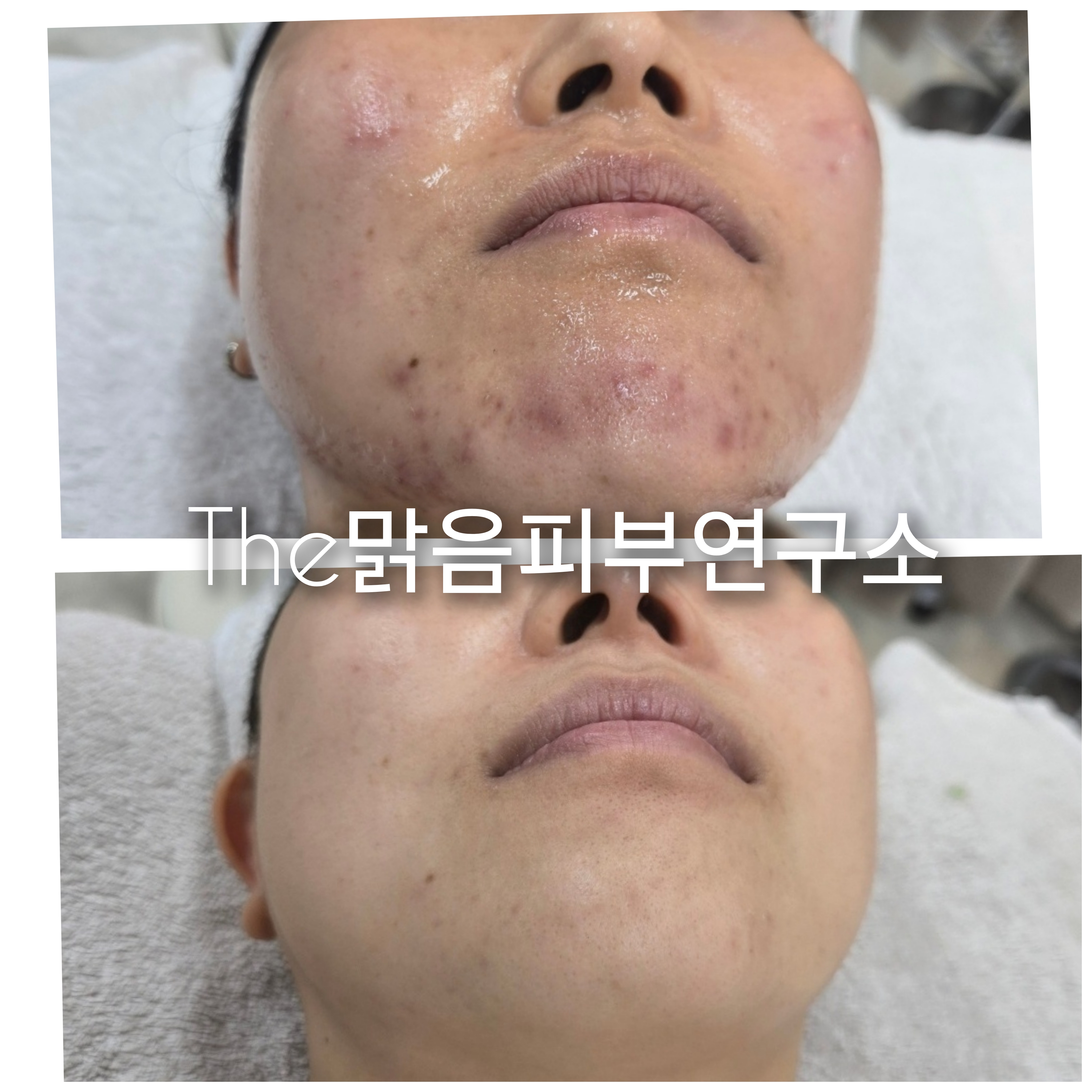 더맑음피부연구소 대표 이미지