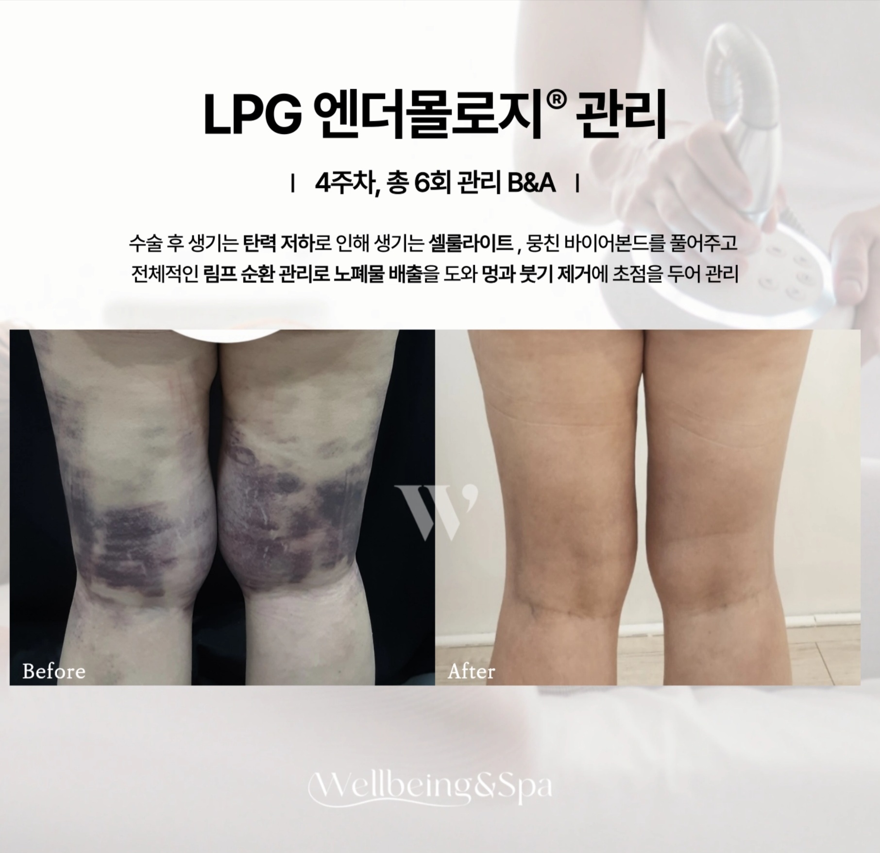 비타C스킨갤러리