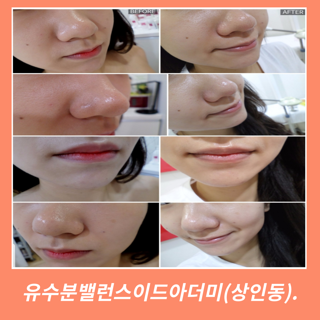 소연에스테틱 상인점