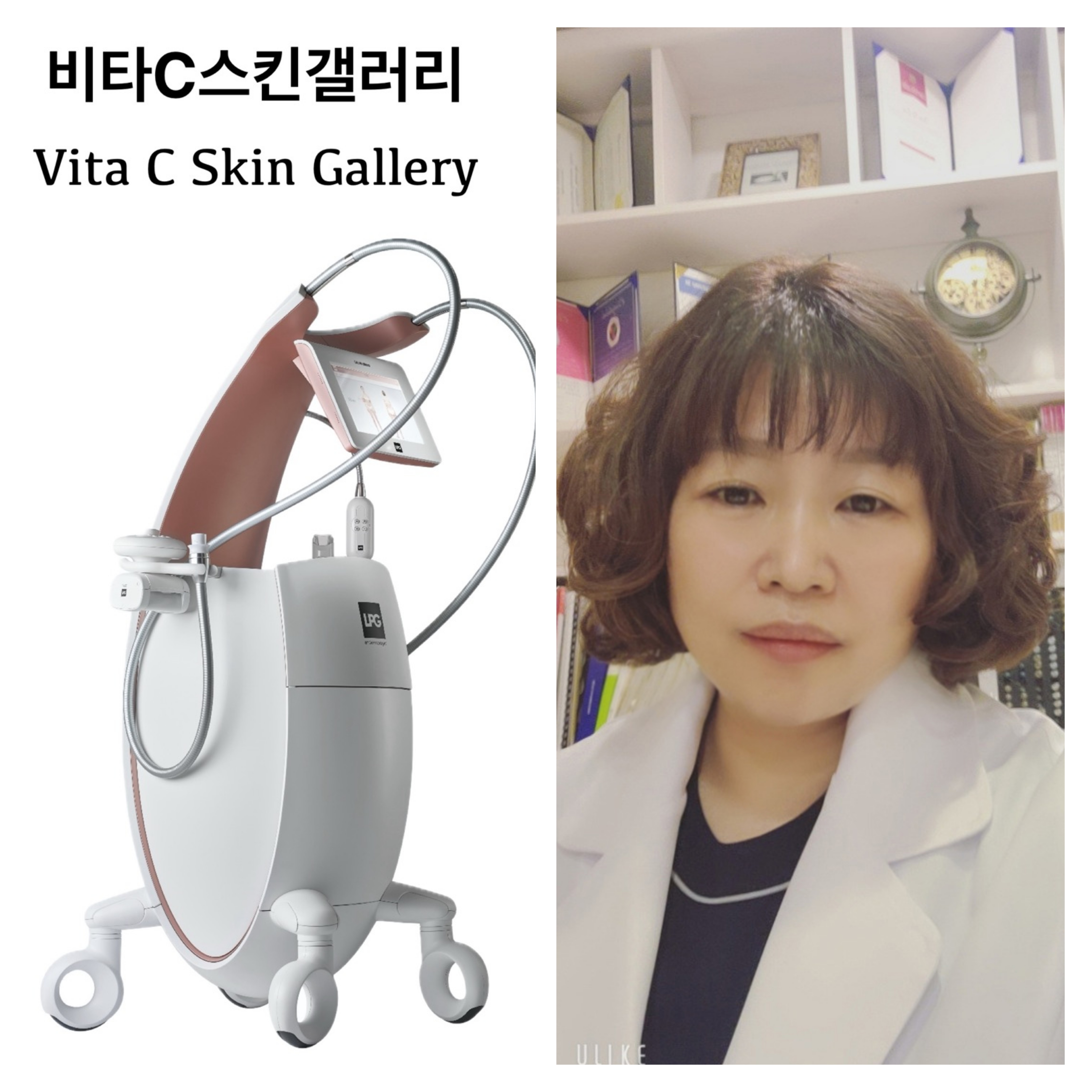 비타C스킨갤러리