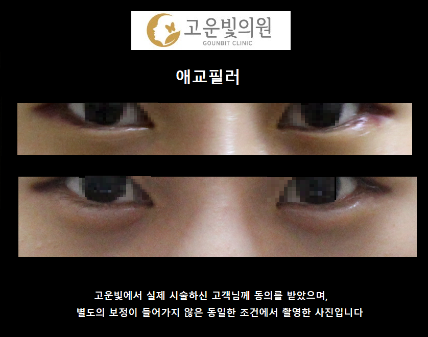 고운빛의원