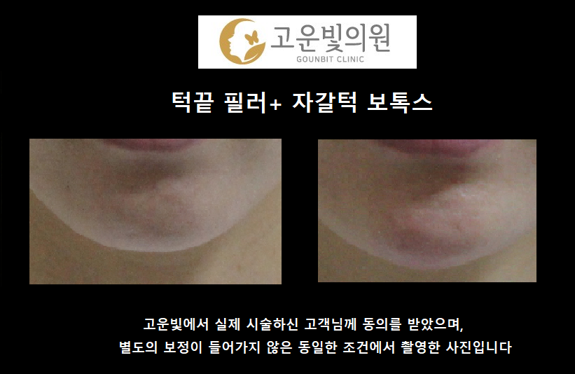 고운빛의원