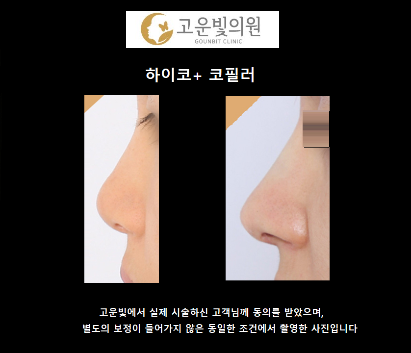고운빛의원