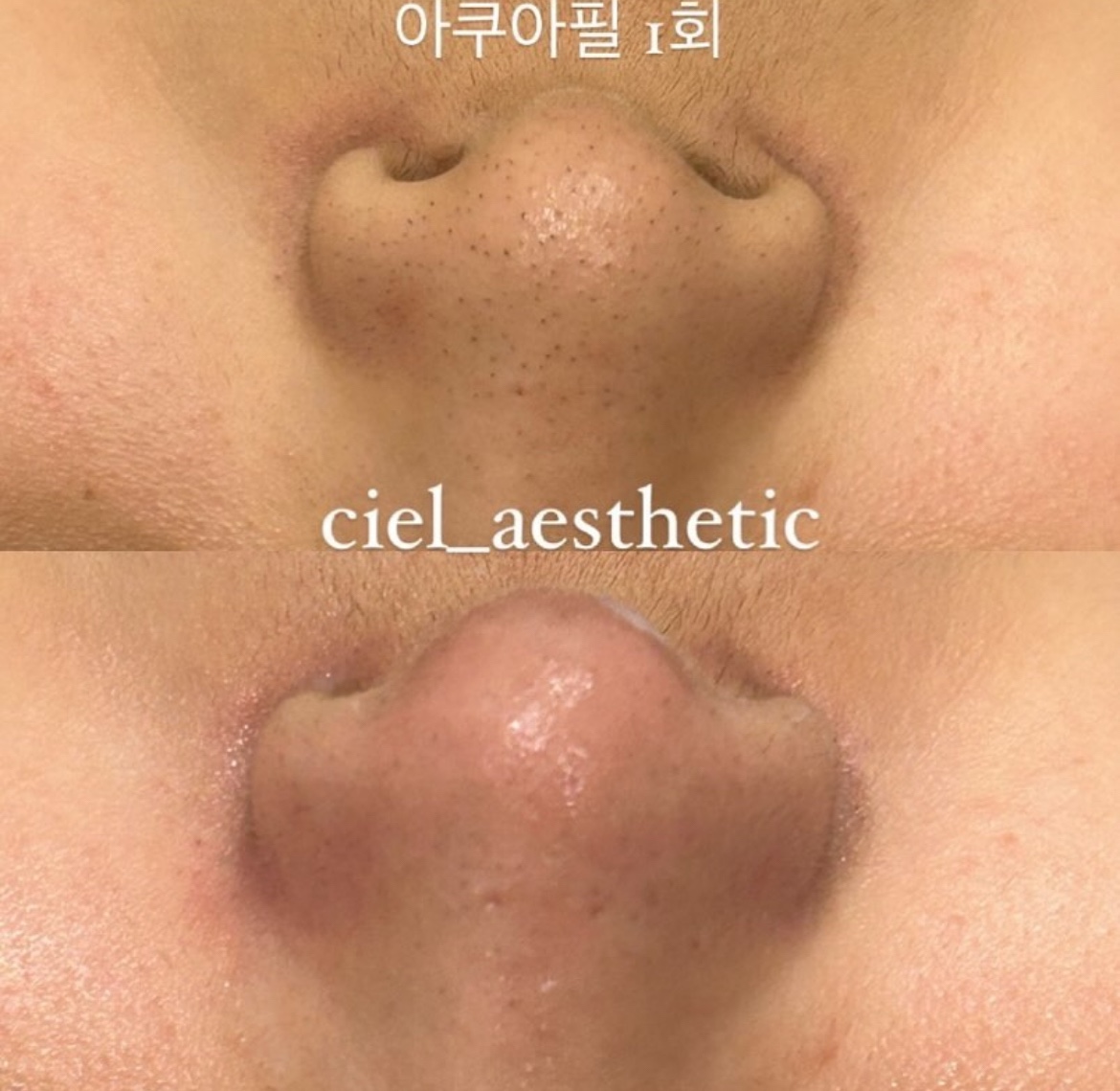 씨엘르에스테틱