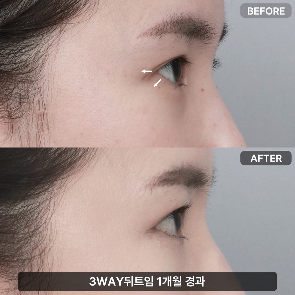 바라본성형외과의원 대표 이미지