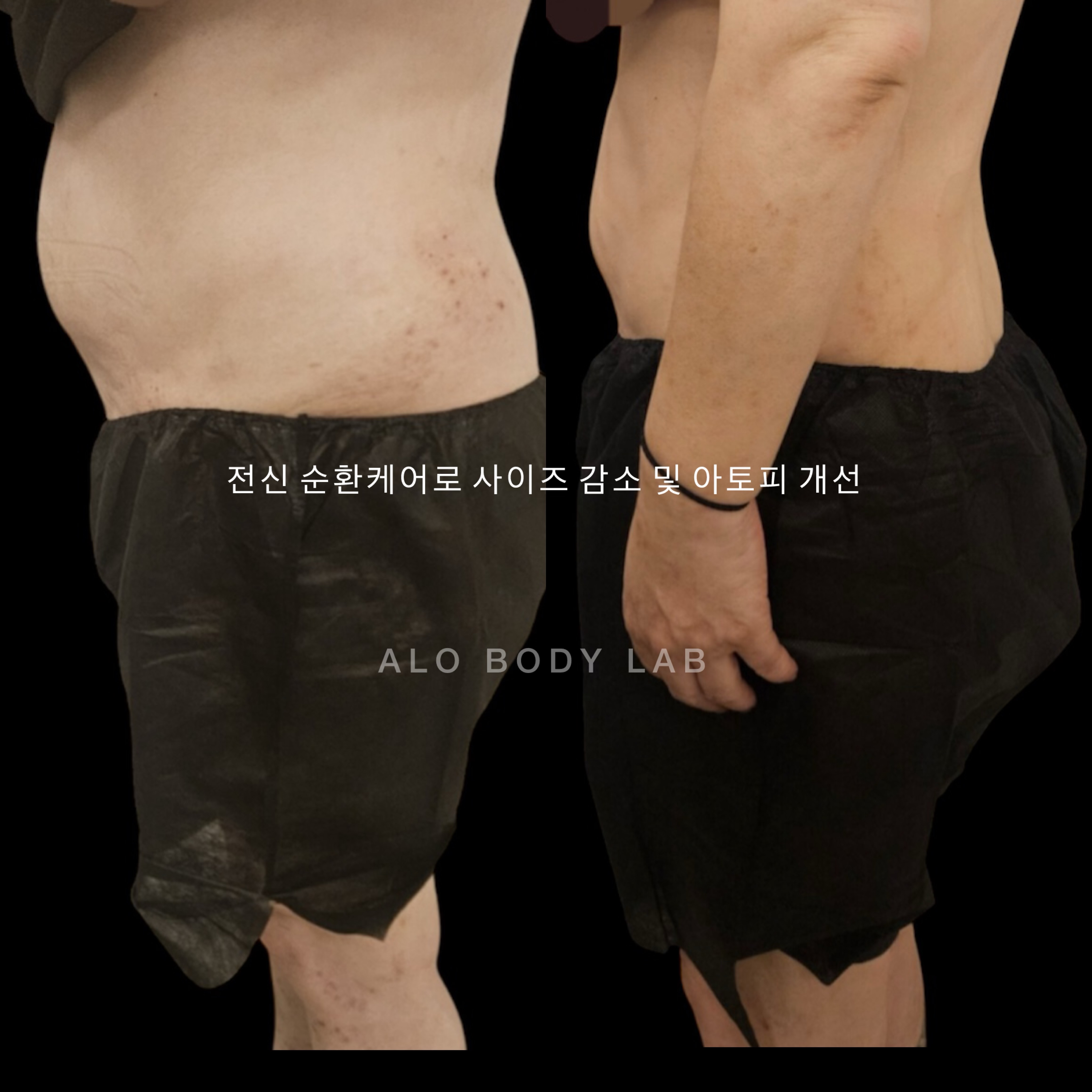 안중 마사지 알로바디랩 photo 2