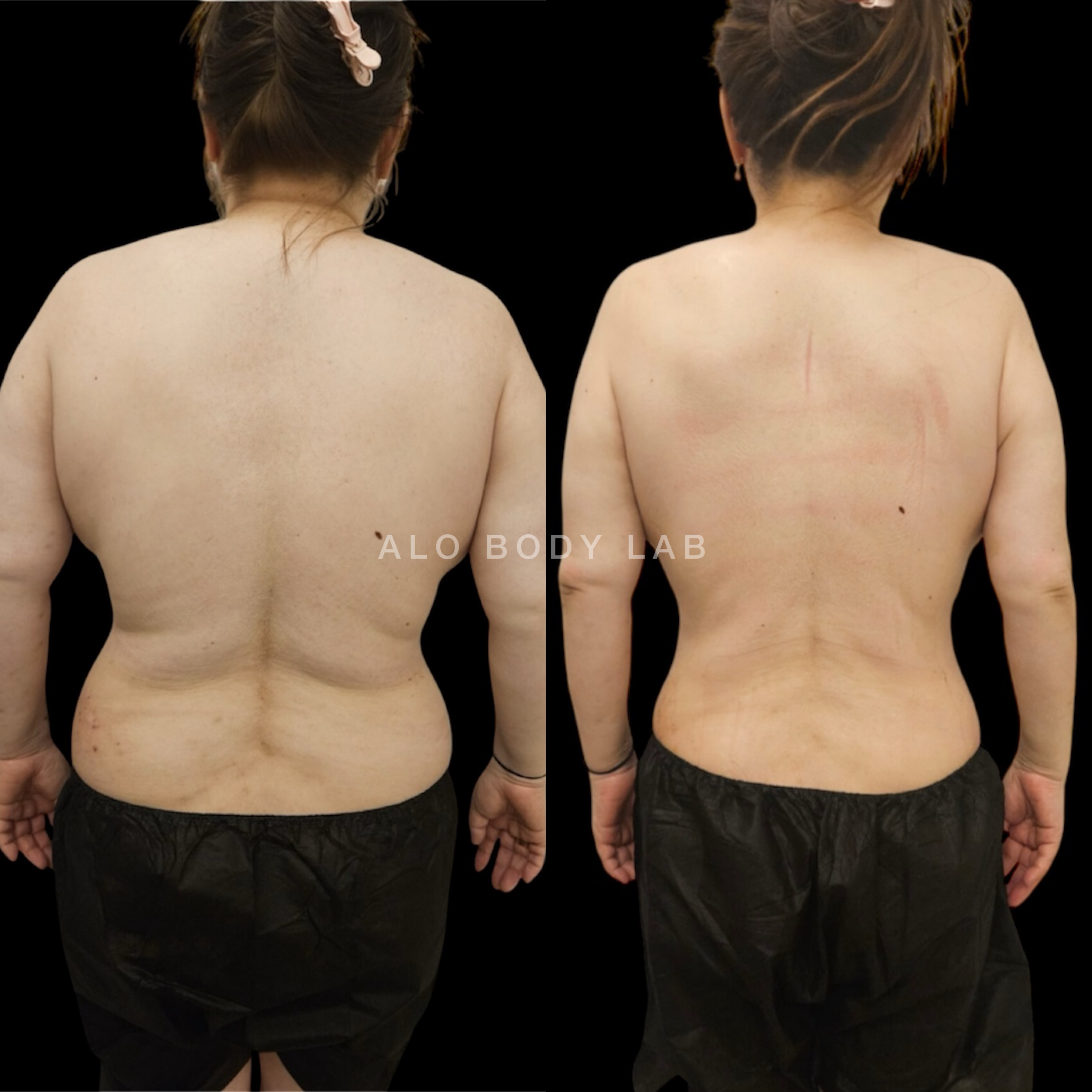 안중 마사지 알로바디랩 photo 4