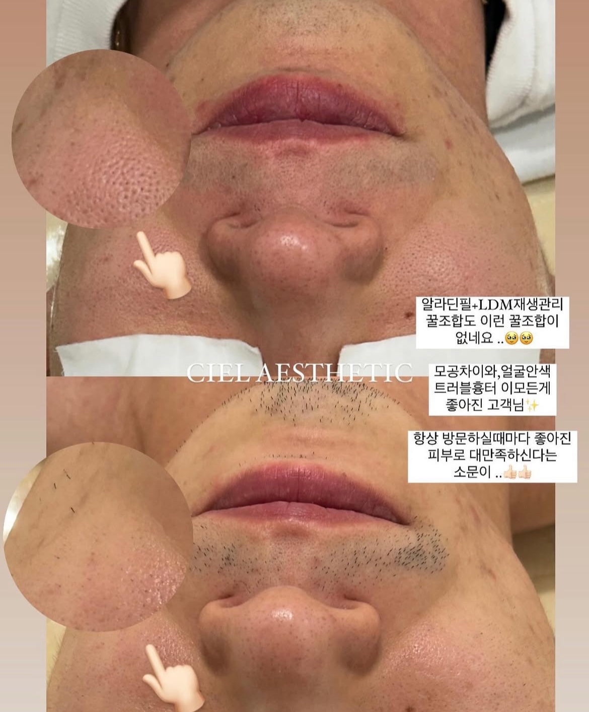 씨엘르에스테틱
