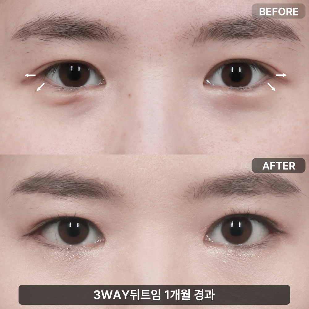 바라본성형외과의원 대표 이미지