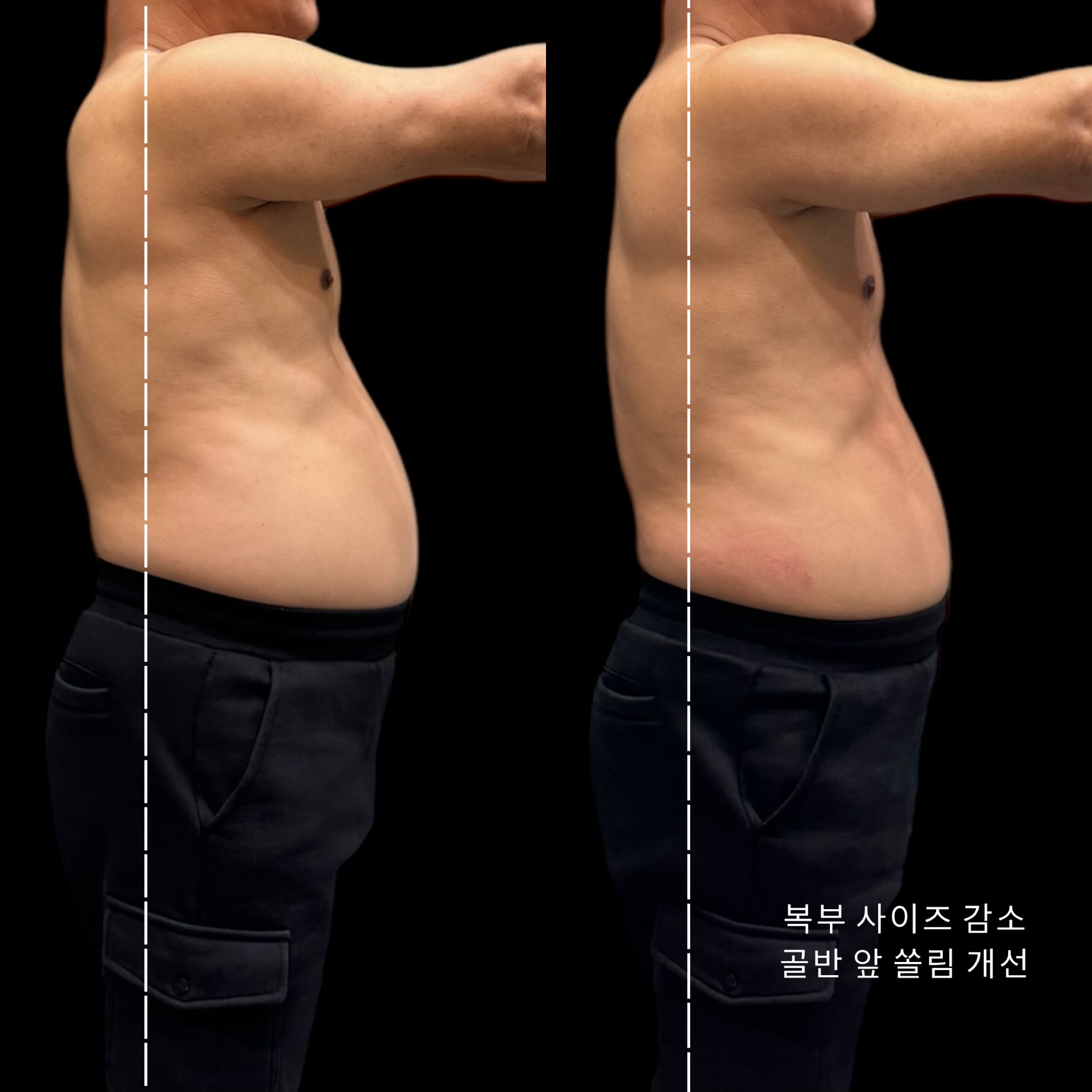 안중 마사지 알로바디랩 photo 3