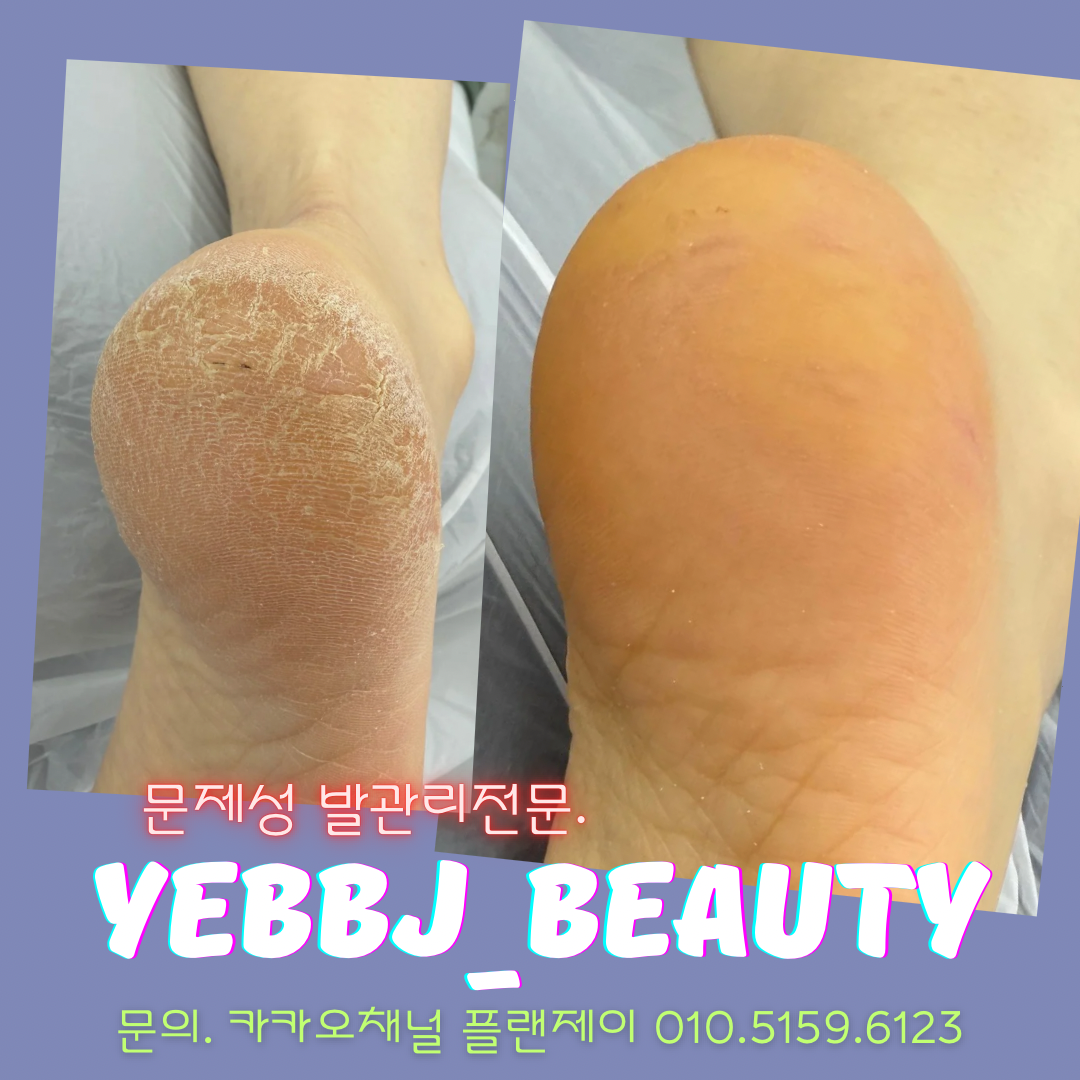 예쁘제이뷰티