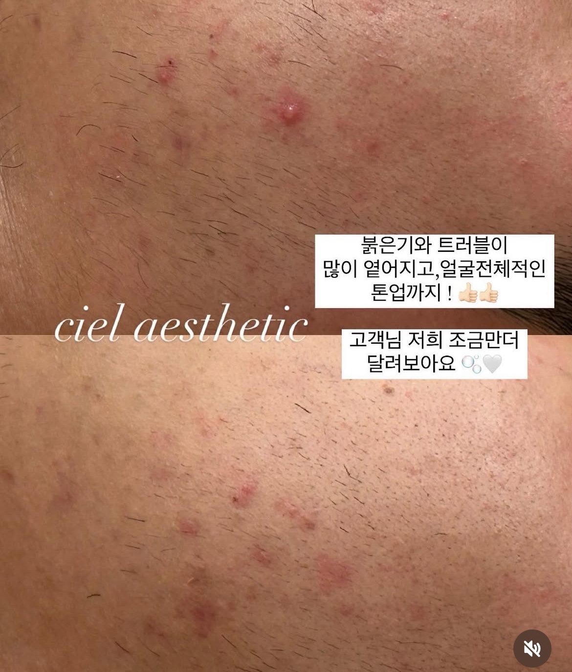 씨엘르에스테틱