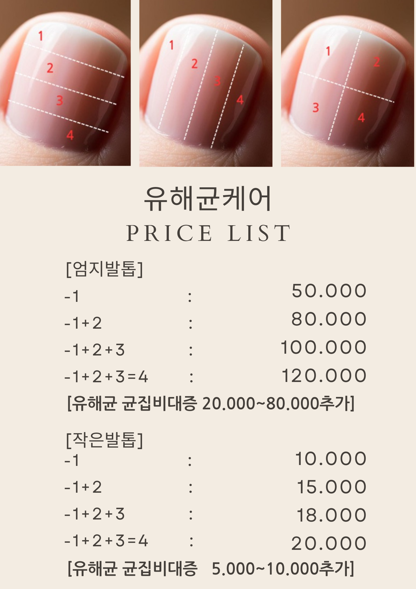 은계발톱닥터네일그리다