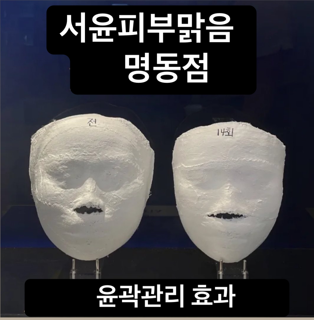 서윤피부맑음 명동점 대표 이미지