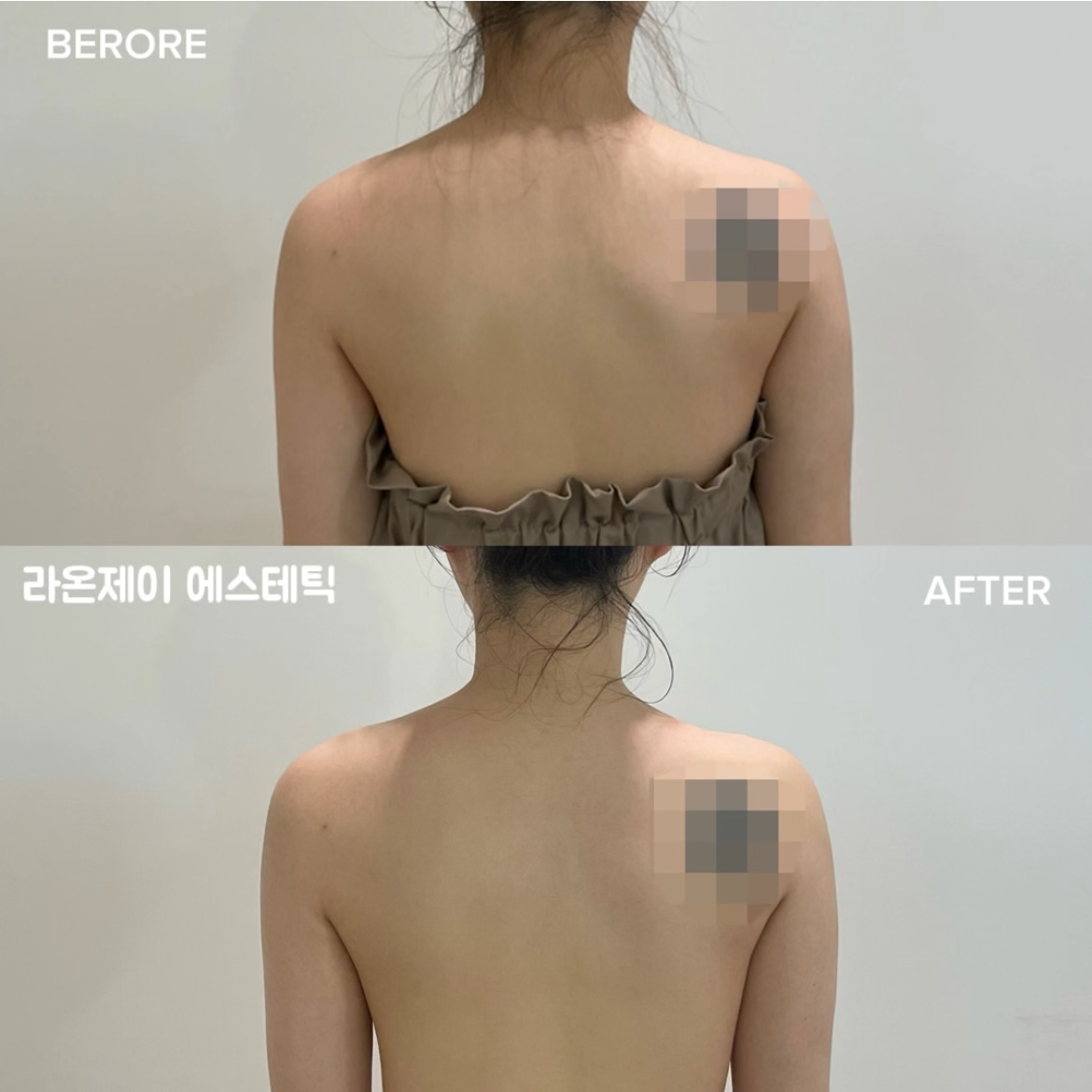 라온제이 에스테틱