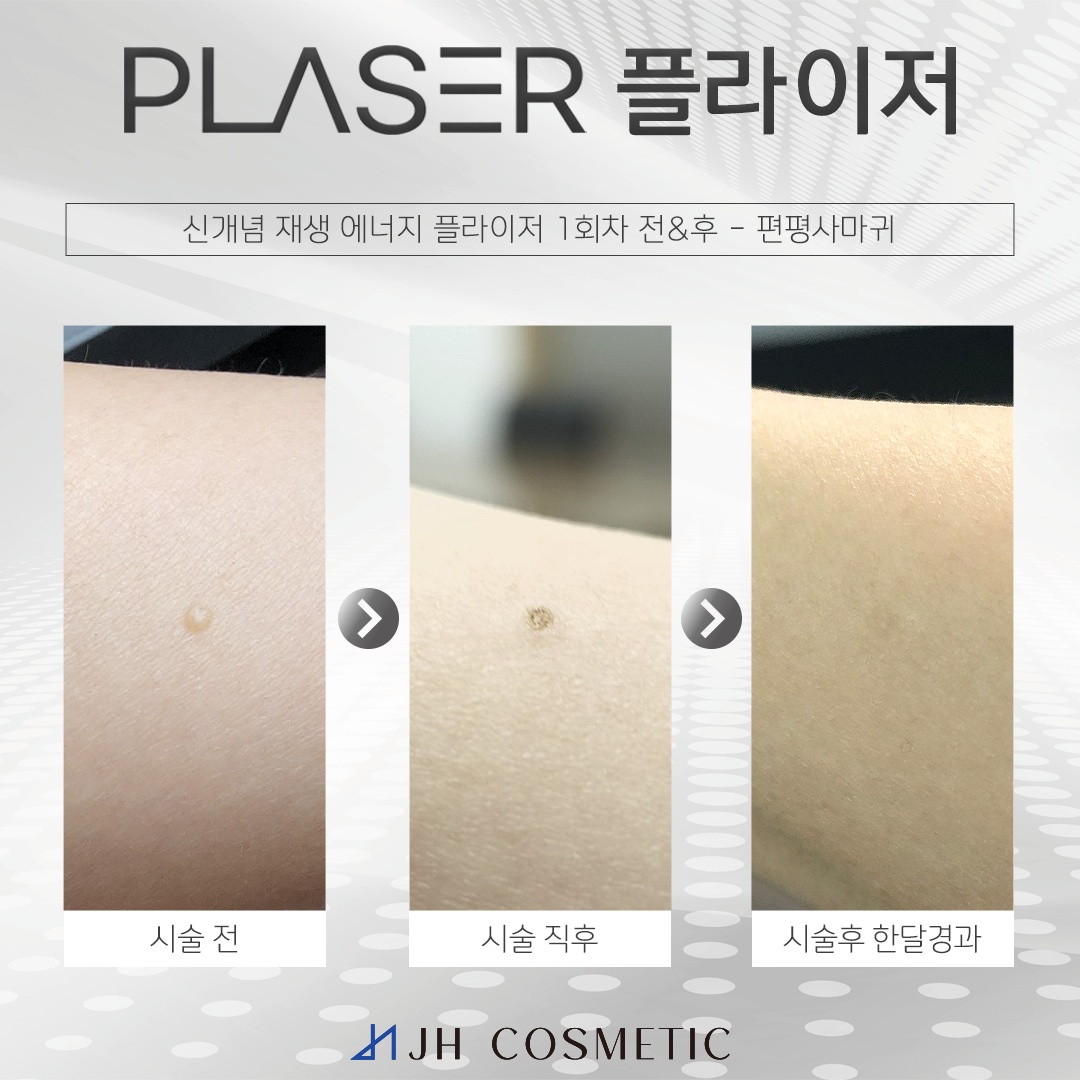 더맑은스킨 경기광주태전점