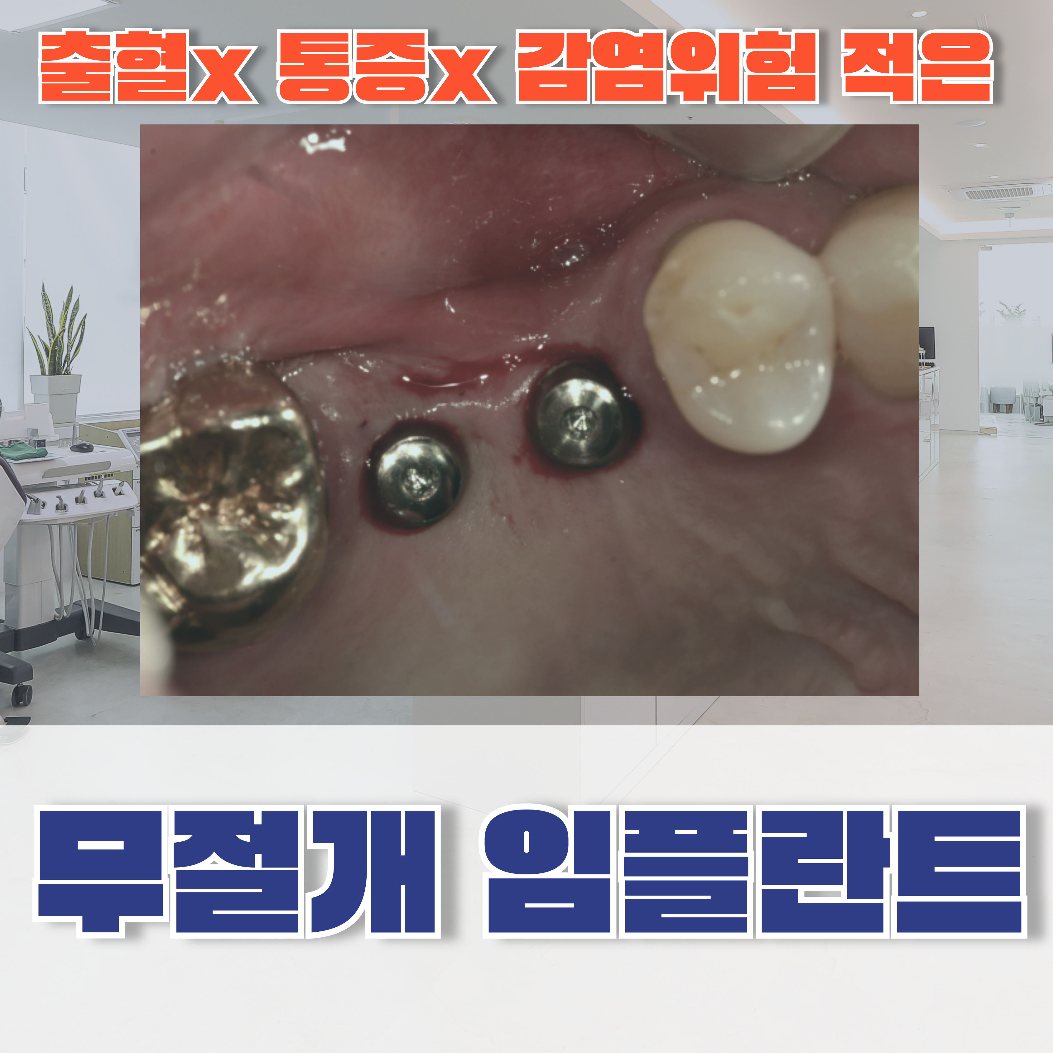 알프스치과의원 대표 이미지