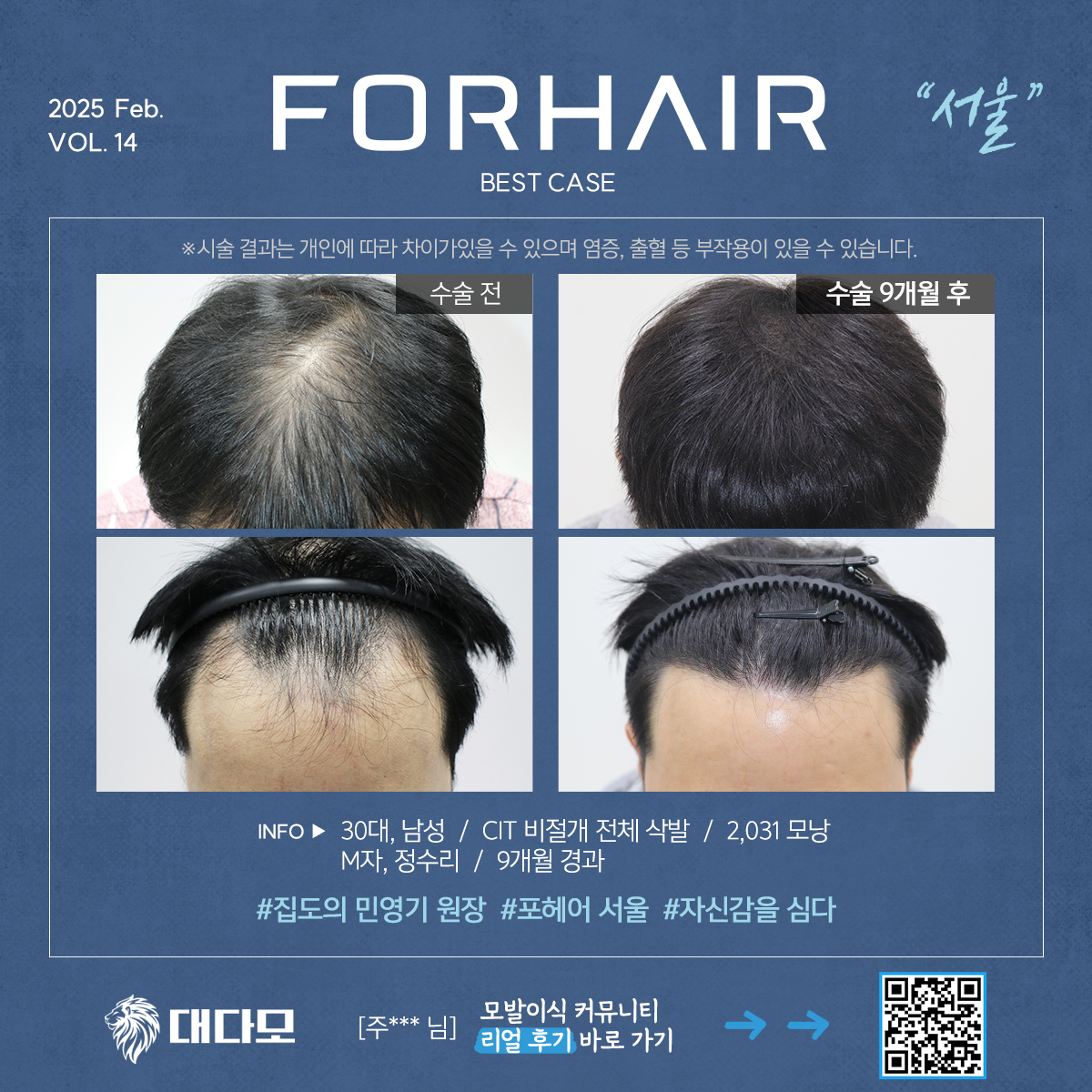 포헤어의원 서울점 대표 이미지