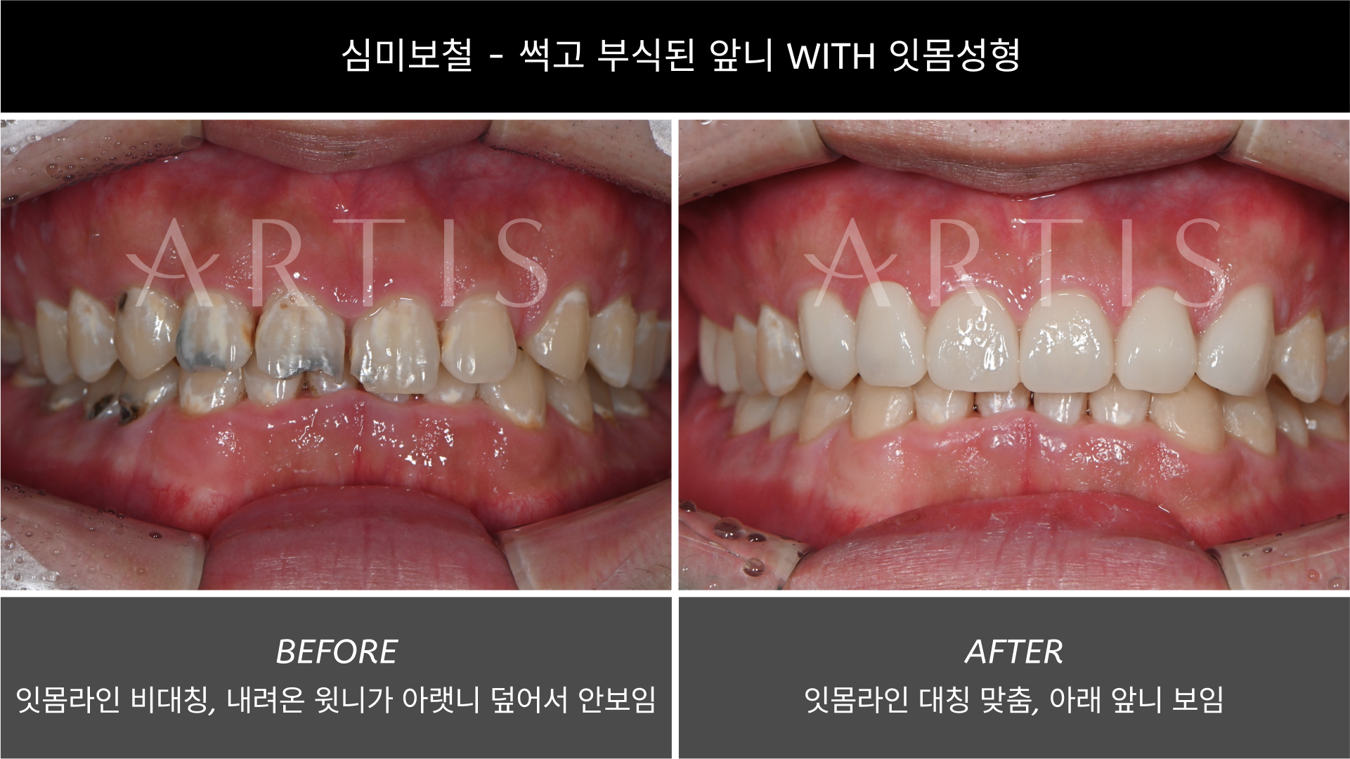 아티스치과의원 왕십리 대표 이미지