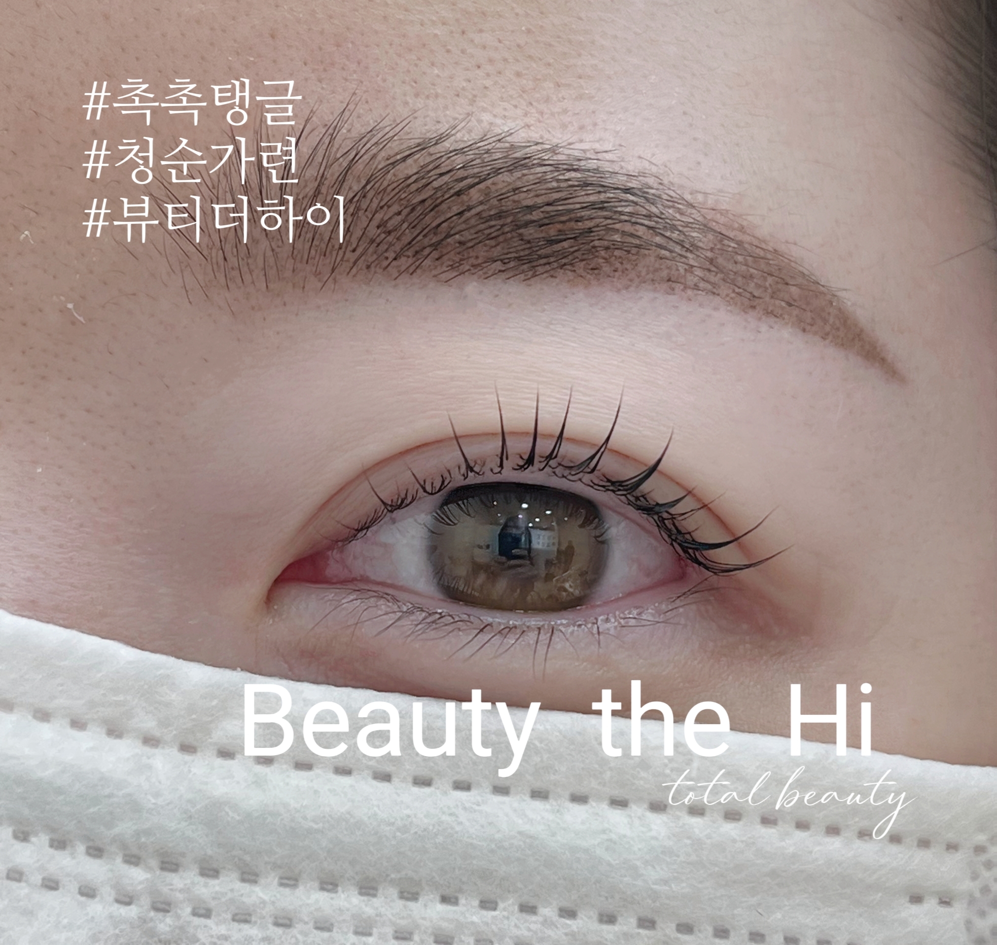 뷰티더하이