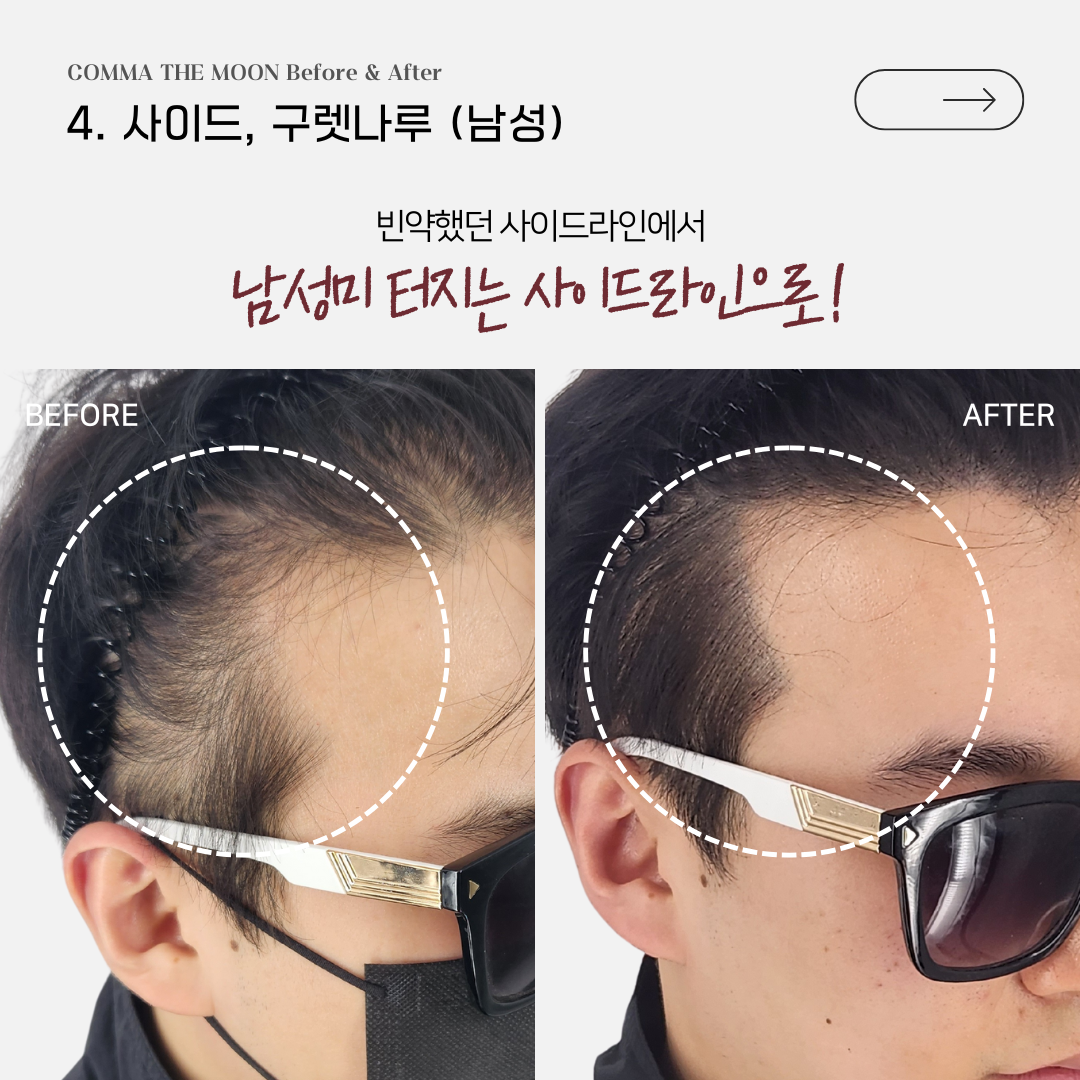 콤마더문 대구 대표 이미지