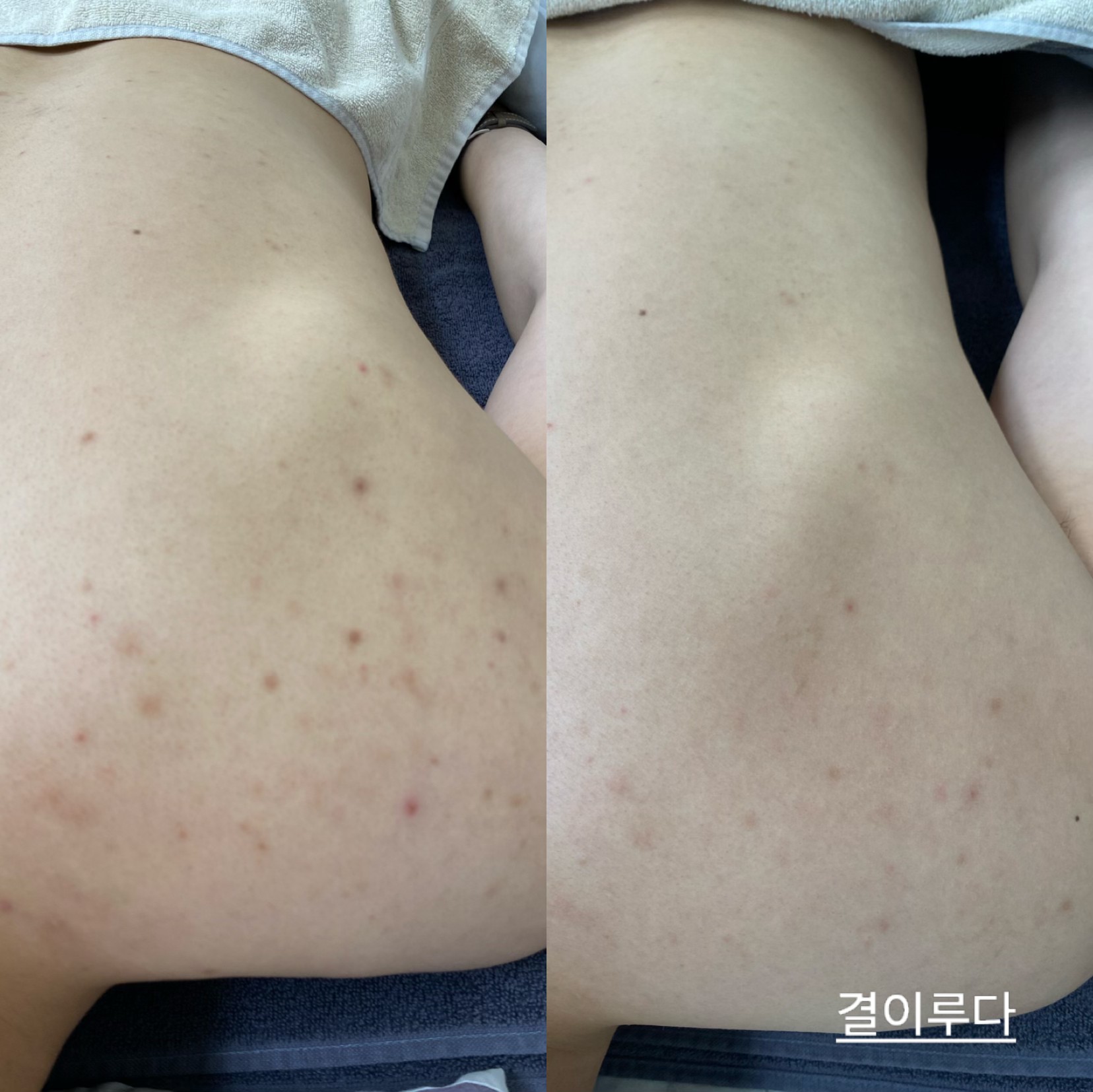 결이루다 photo 8