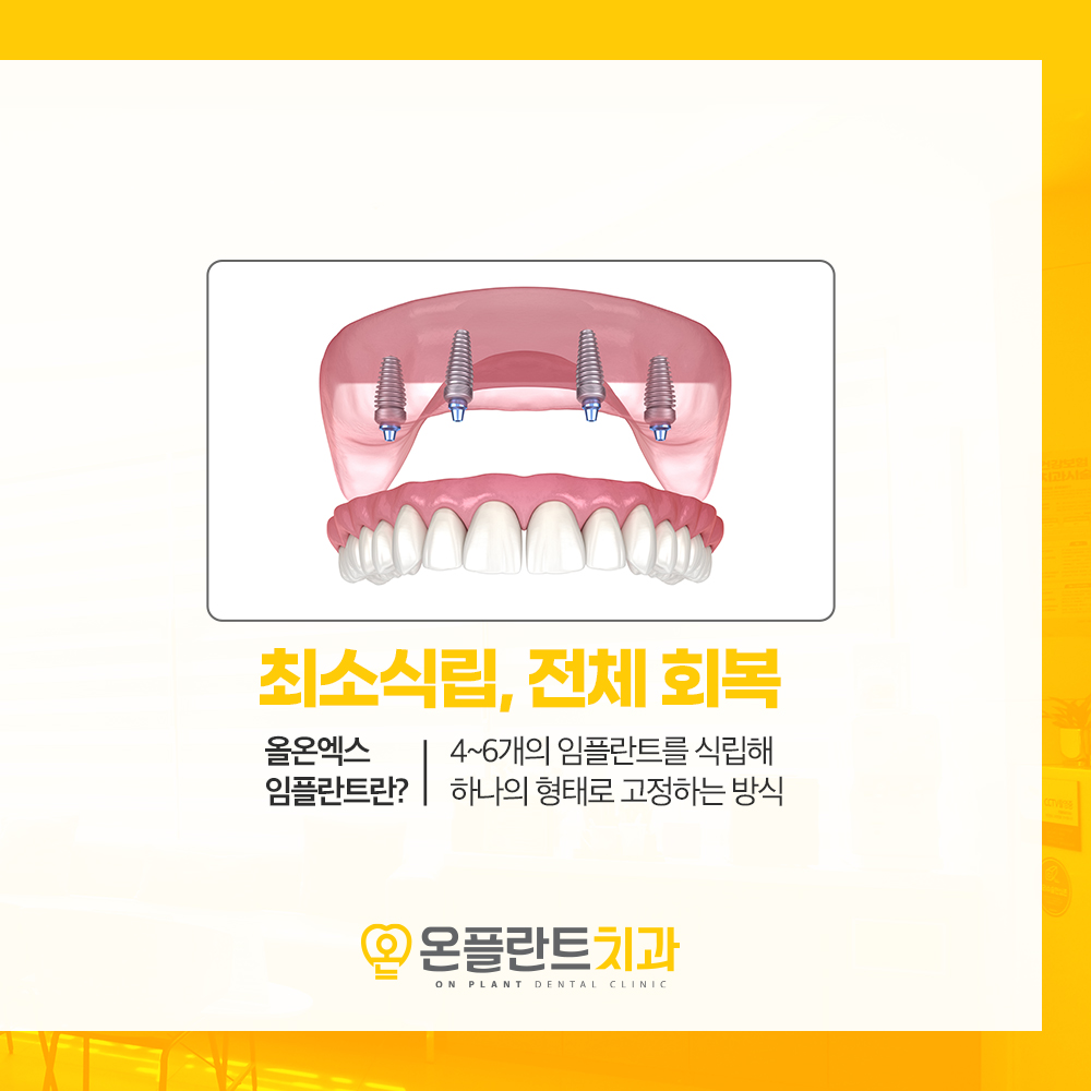 온플란트치과 대표 이미지