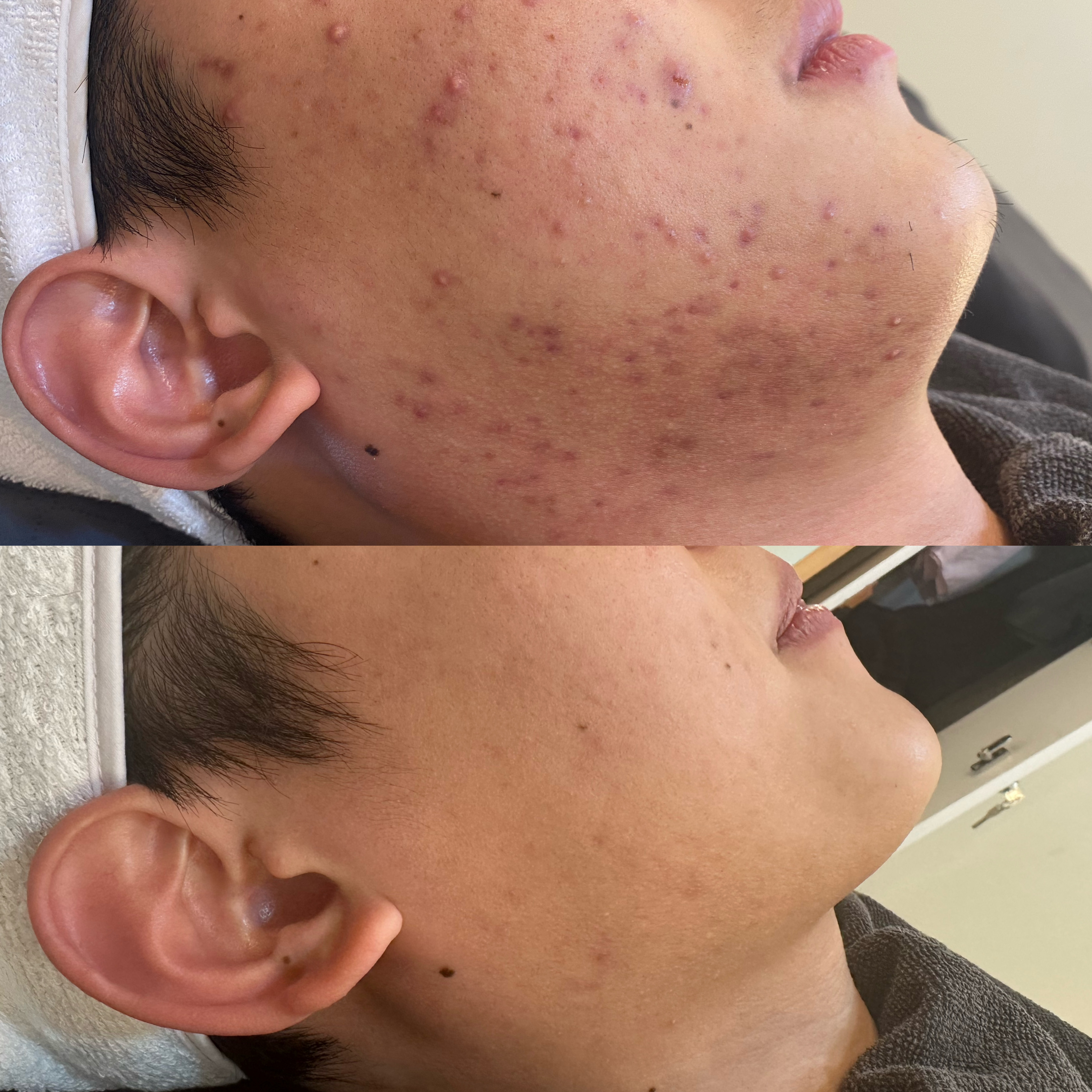 포미뷰티 대표 이미지