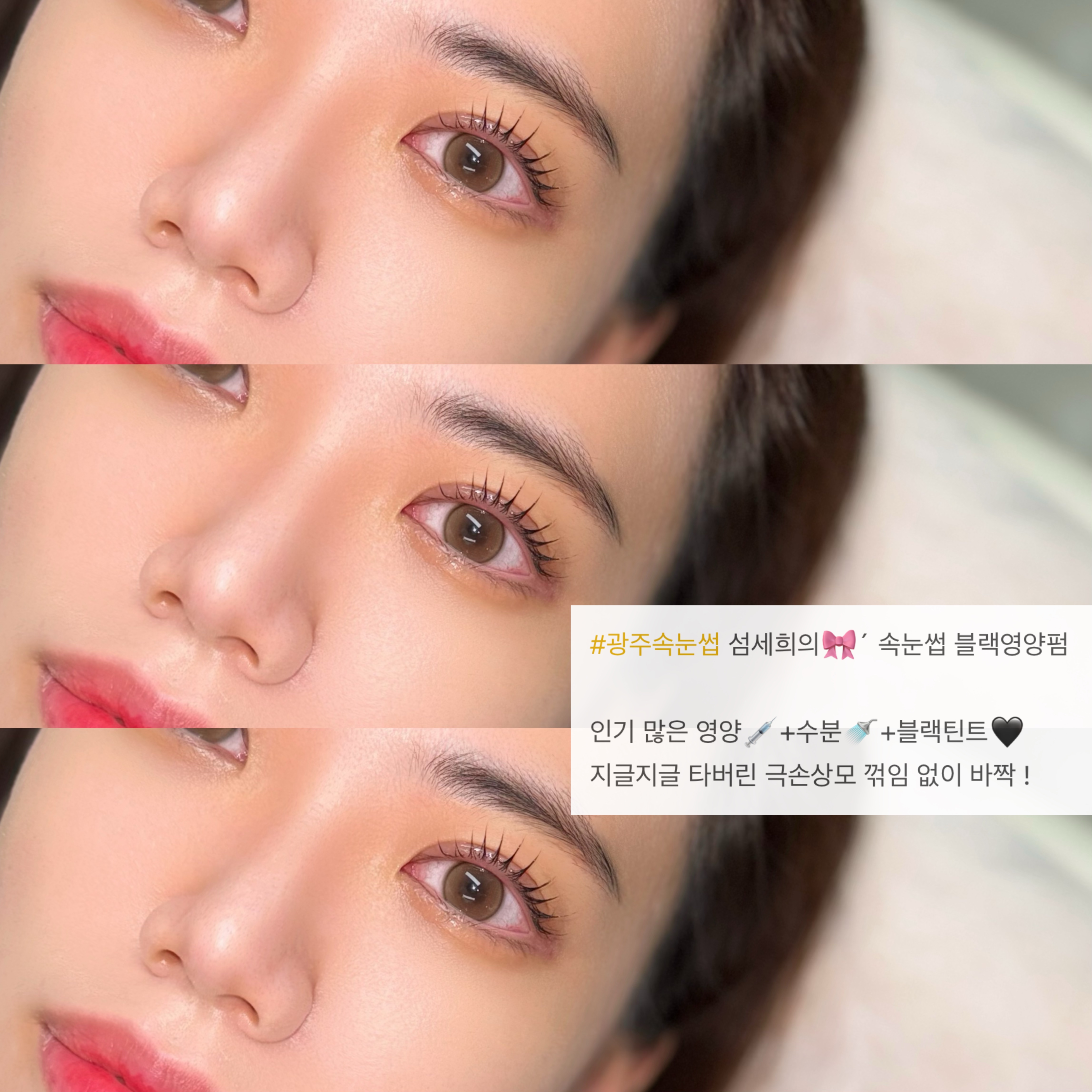 섬세희