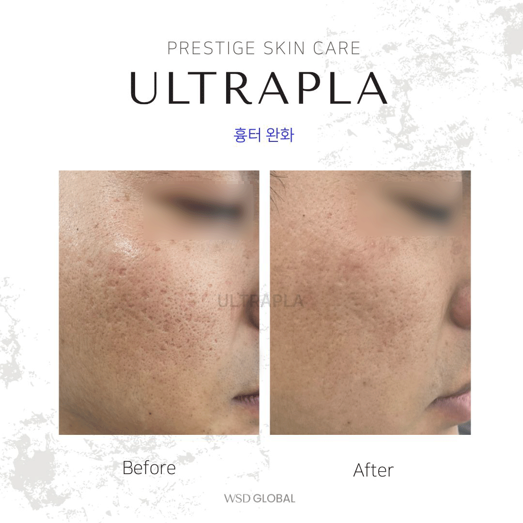 고은피부전문센터 대표 이미지