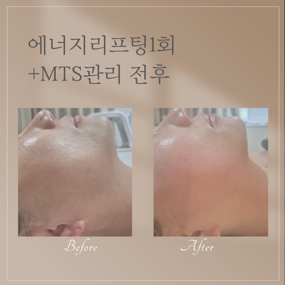 제이제이 에스떼 홍대점 대표 이미지