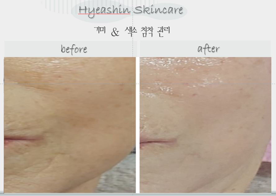 해신스킨케어 대표 이미지
