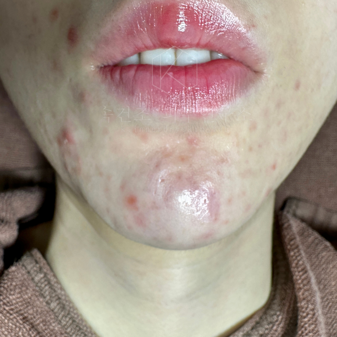 케이속건조피부연구소 대표 이미지