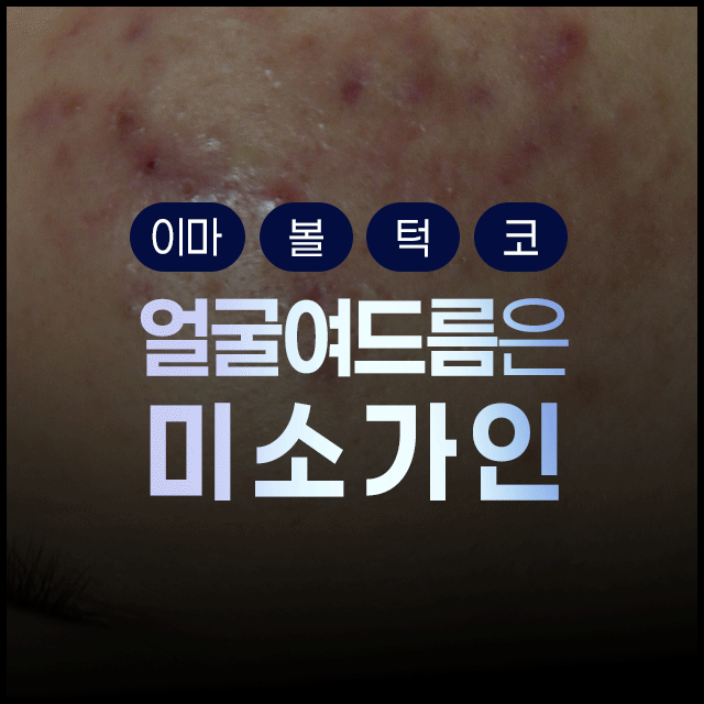 목동미소가인피부과 이미지